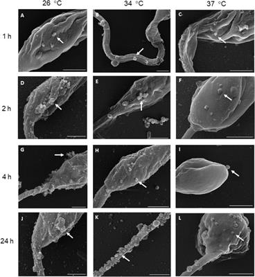 Extracellular Vesicles Released by Leishmania (Leishmania) amazonensis Promote Disease Progression and Induce the Production of Different Cytokines in Macrophages and B-1 Cells